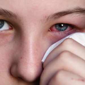 Phòng chống bệnh đau mắt đỏ hiệu quả